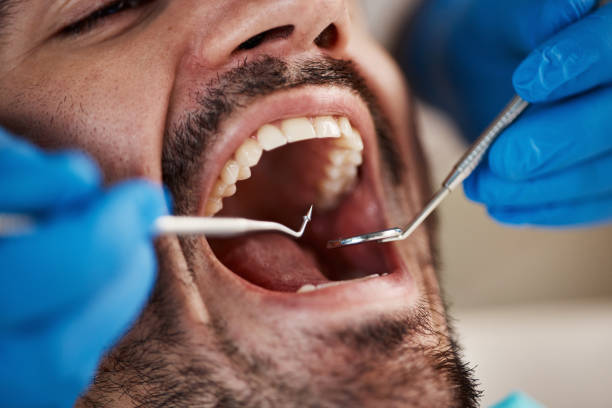 Best Broken Tooth Emergency  in Rocklin, CA